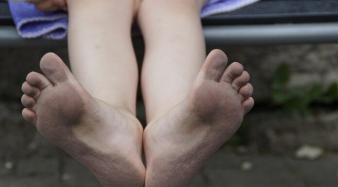 The Safe Way to Remove a Foot Callus The Safe Way To Remove A Foot Callus