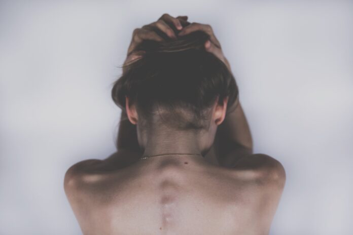 Spine sureon Back view of a shirtless person with hands clasped on top of their head, hair gathered underneath.